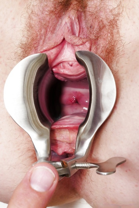 Mature lady undergoing hairy pussy examination at gyno office 26731630